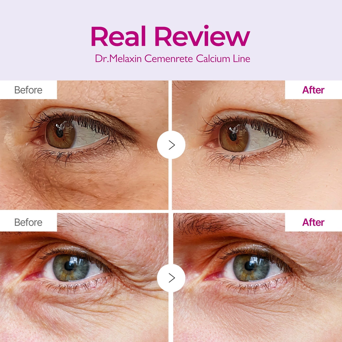 Cemenrete Calcium Volume Eye patch 60ea